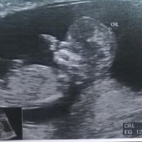 12 semanas
