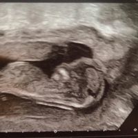 13 semanas