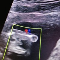 15 semanas