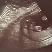 17 semanas