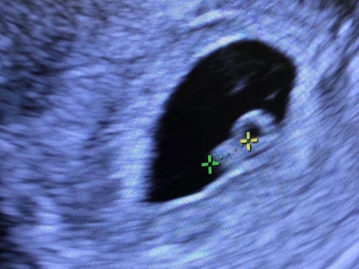 Futuras mamás Junio 2019 - 1