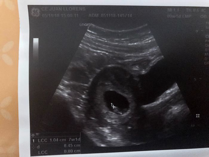 Futuras mamás Junio 2019 - 1