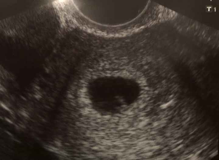 Futuras mamás Junio 2019 - 1