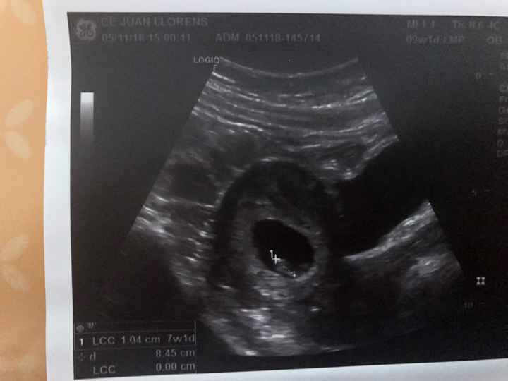 Futuras mamás Junio 2019 - 1