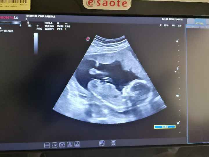 Futuras mamas noviembre 2020 - 1