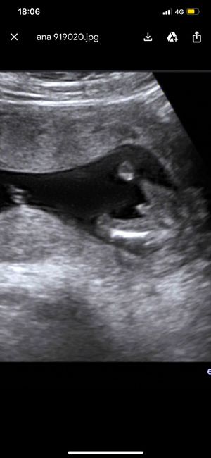 Futuras Mamas Julio 2020. - 1