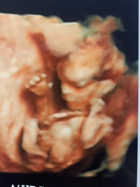 Futuras Mamas Julio 2020. - 2