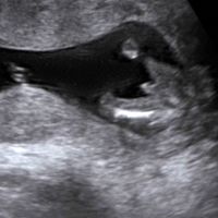 Futuras Mamas Julio 2020. - 1