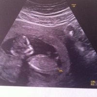El consultorio de Lita para futuras mamis - 1