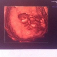 El consultorio de Lita para futuras mamis - 2