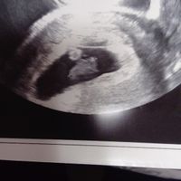 7 + 3 