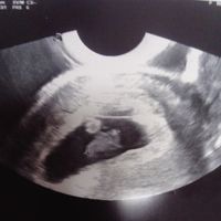 7+3 vaginal