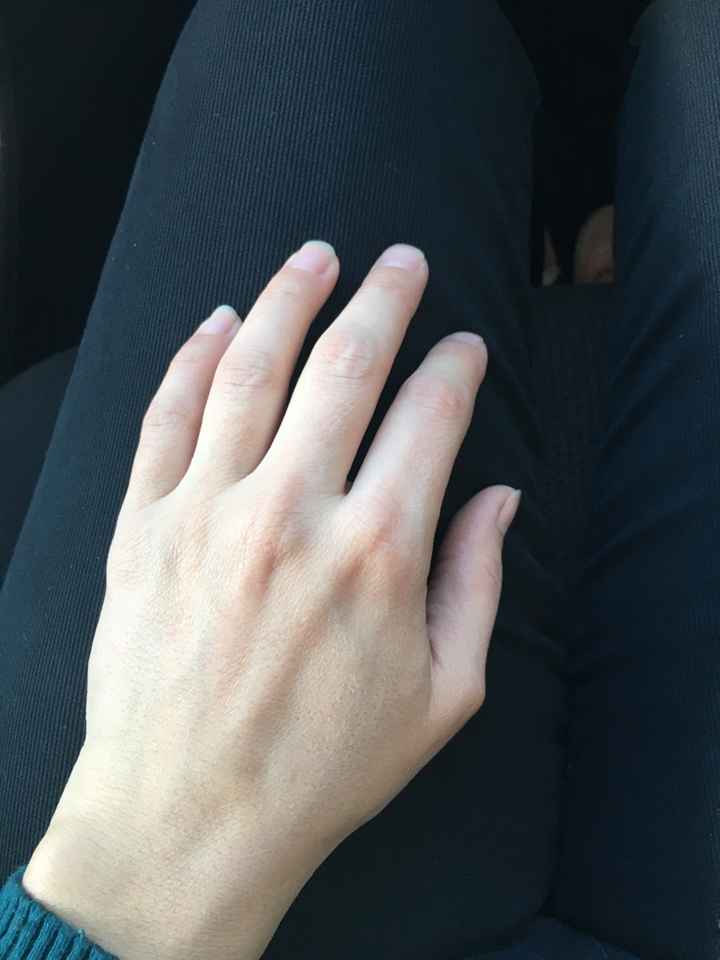 ¡Enséñanos tu anillo de prometida! - 1