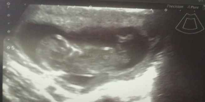 12semanas