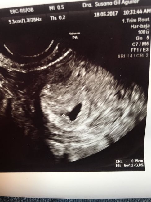 Futuras mamis enero 2018 - 1