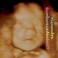Alexandra 25 semanas