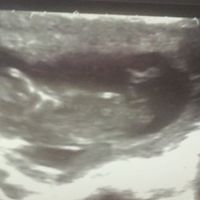 12semanas
