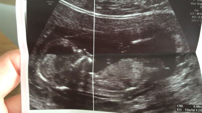 Futuras mamas noviembre 2020 3