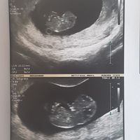 Futuras mamás enero 2019 - 1