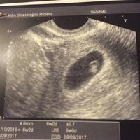 Mamis agosto 2017 - 1