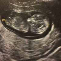 Mamis agosto 2017 - 1