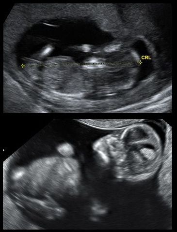 mi bebé 2