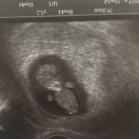  Futuras mamás agosto 2018 - 1