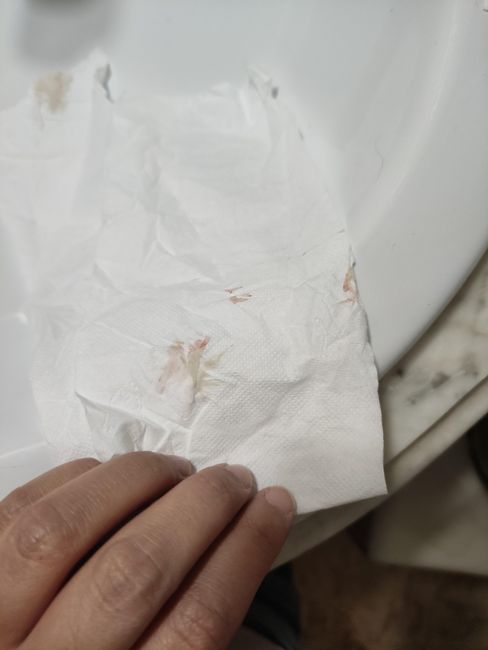 Sangrado de implantación o principio de regla? - 2