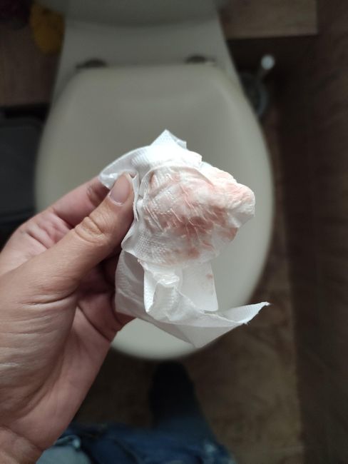 Sangrado de implantación o principio de regla? - 3