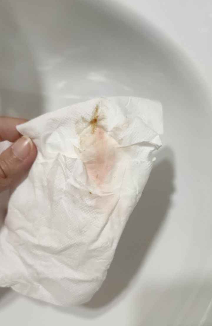 Sangrado de implantación o principio de regla? - 1