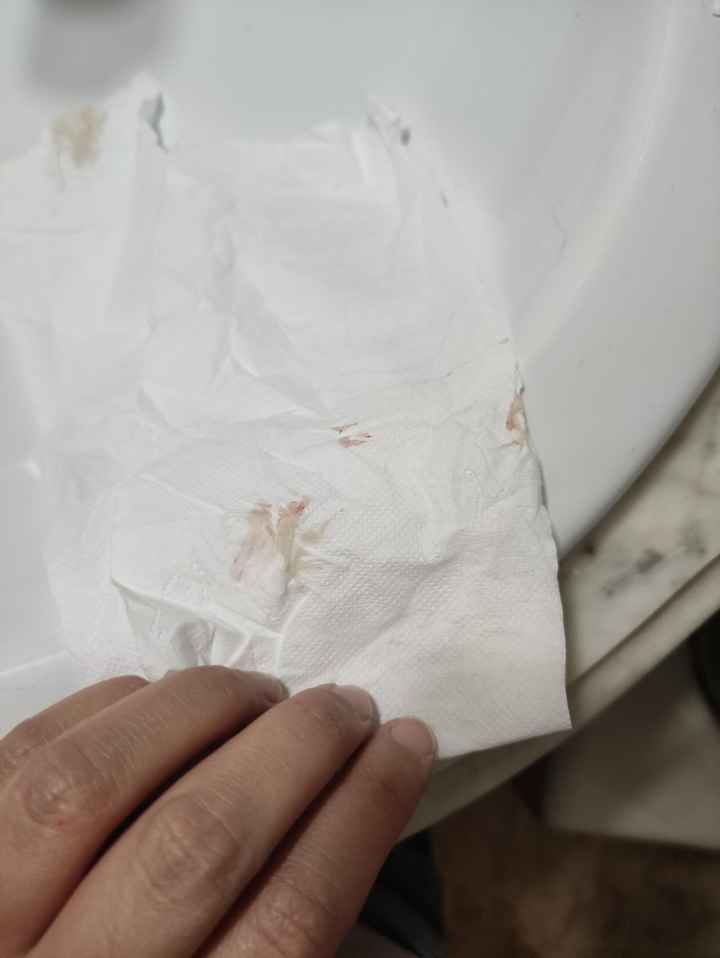 Sangrado de implantación o principio de regla? - 2