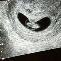 Mamis julio 2017 - 1