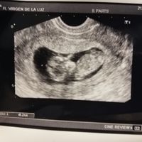 Ayuda con método ramzi: niño o niña? - 1
