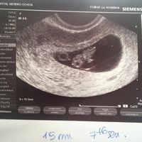 Ayuda con método ramzi: niño o niña? - 1