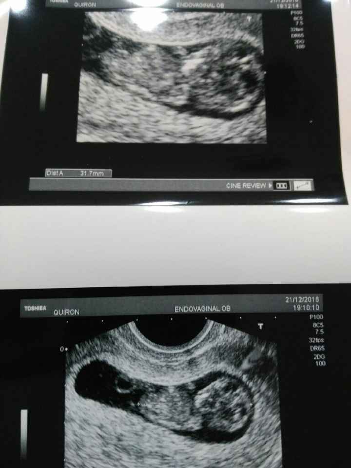 Mamis julio 2017 - 1