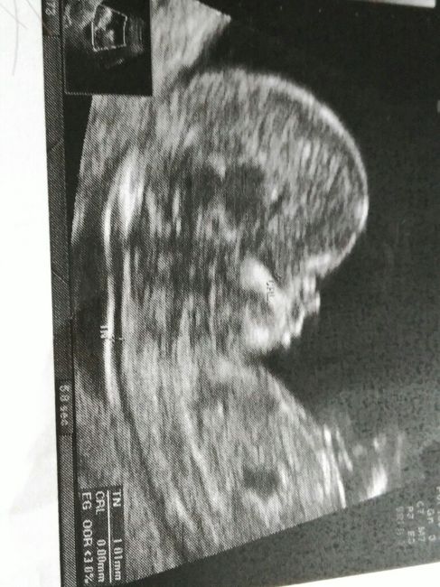 Mamis julio 2017 - 1