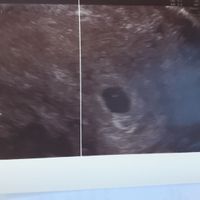 Futuras mamás Mayo 2021🤰♥️ - 1