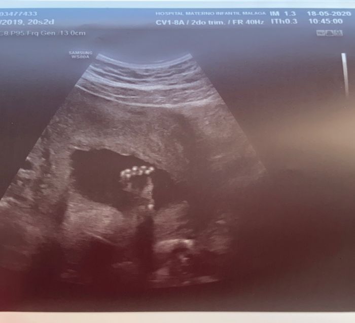 Futuras mamas octubre 2020 - 1