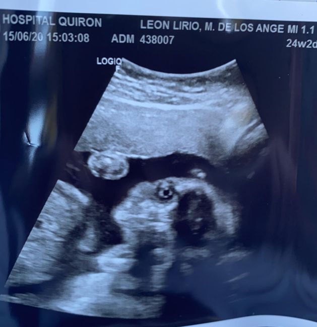Futuras mamas octubre 2020 - 1