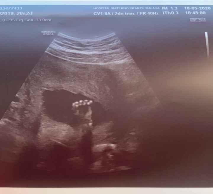 Futuras mamas octubre 2020 - 1