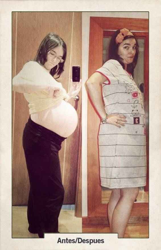 antes/despues