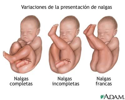 presentacion