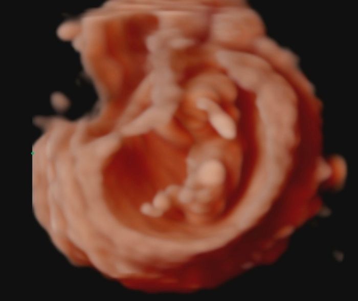 Futuras mamas Diciembre 2020 - 1