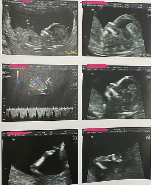 Futuras mamas Diciembre 2020 - 1