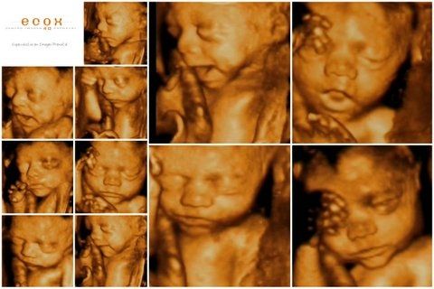 Izan 27 semanas 