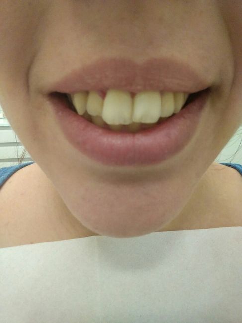 Acabe con el dentista - 2