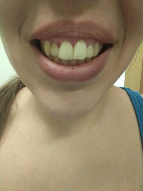 Acabe con el dentista - 3