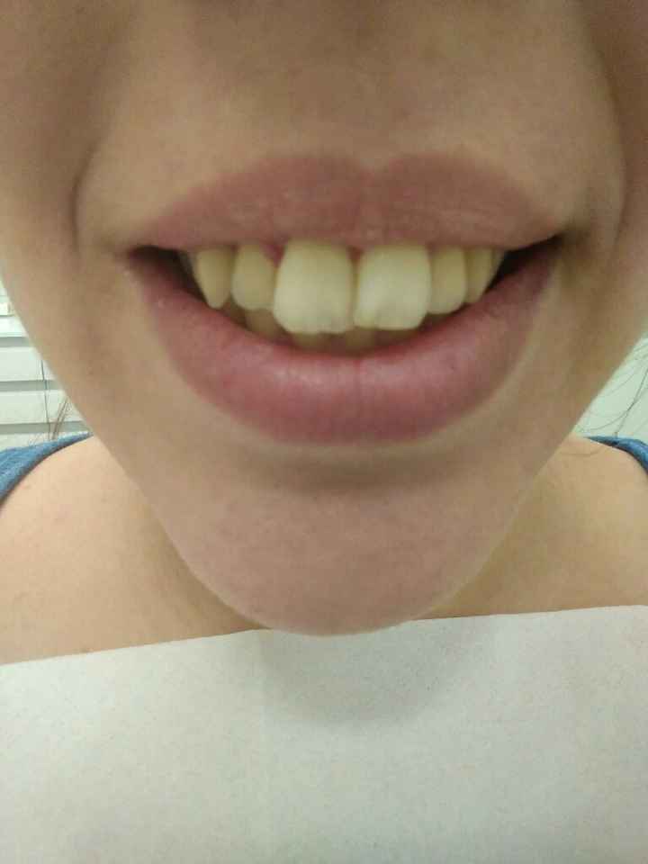 Acabe con el dentista - 2