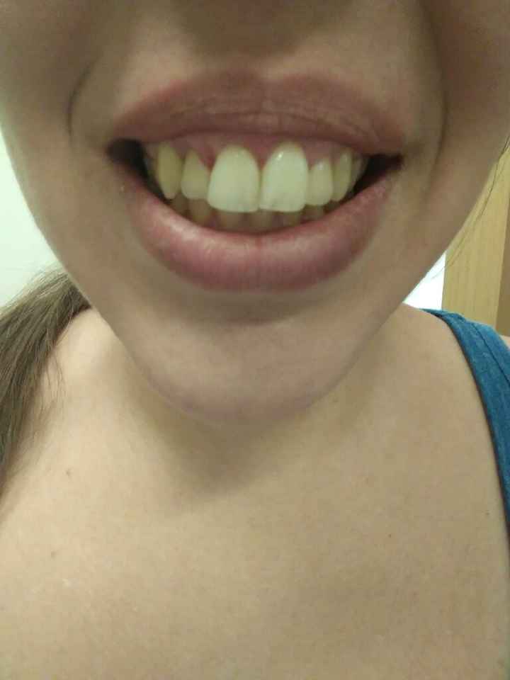 Acabe con el dentista - 3