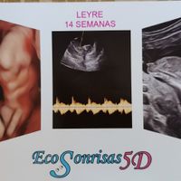 Futuras mamás diciembre 2021 ☃️ - 1